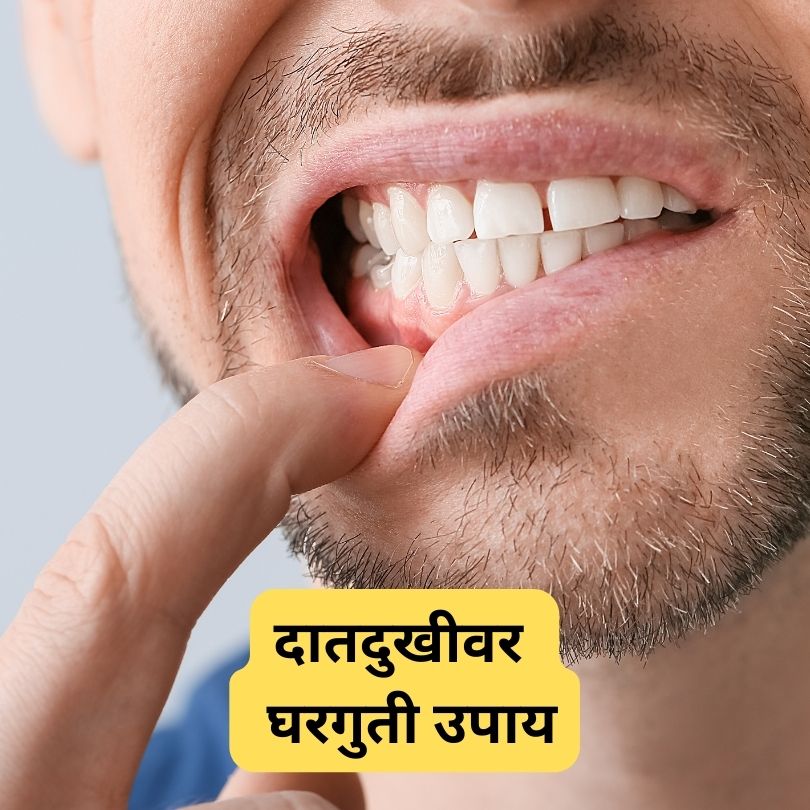 दात दुःखीवर करा हे घरगुती उपाय | Tooth Pain Home Remedy In Marathi 2023